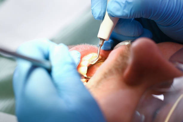 Best Emergency Gum Pain Relief  in Lely Resort, FL